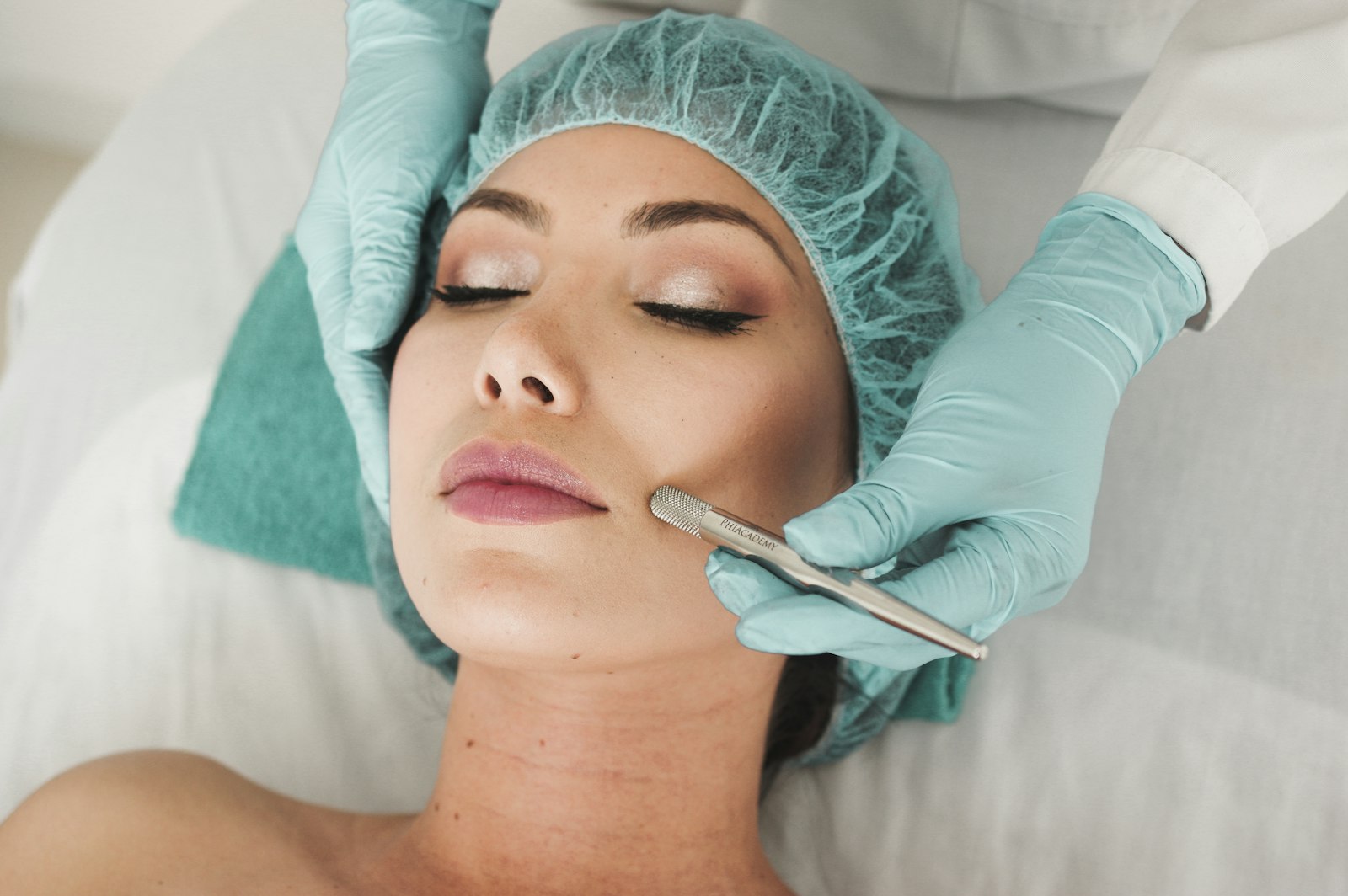 RF Microneedling